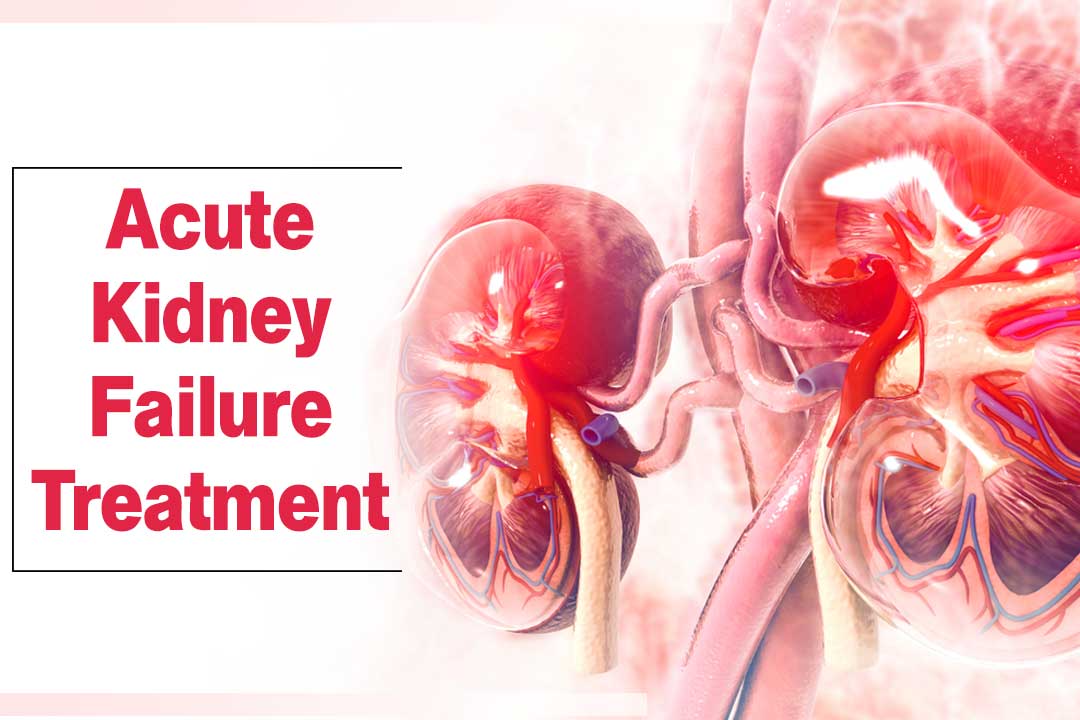 Acute Kidney Failure Treatment