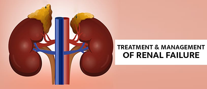 Treatment-and-Management-Renal-Failure