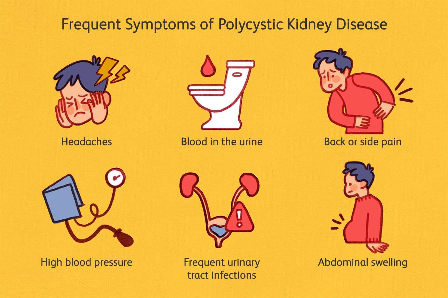 polycystic-kidney-disease-causes-signs-and-symptoms-diagnosis-and