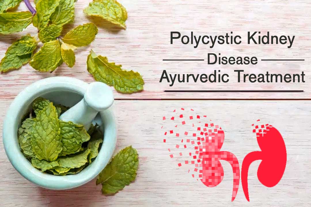 pkd-ayurvedic-treatment